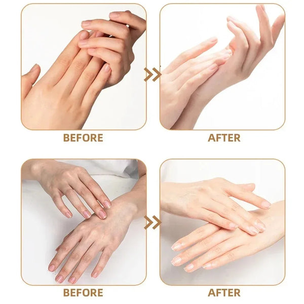 Finger Joint Acupoint Massager