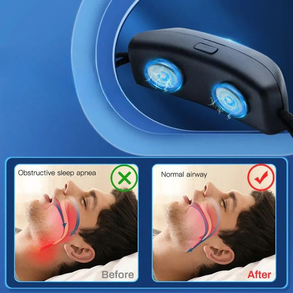 Snore reducing gadget

